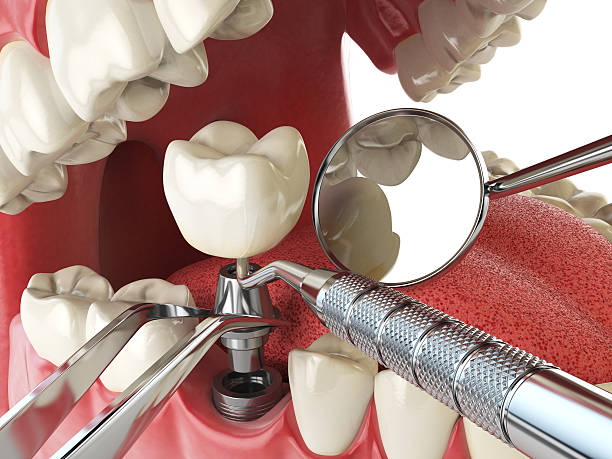 Best Emergency Orthodontic Repairs in Broad Creek, NC